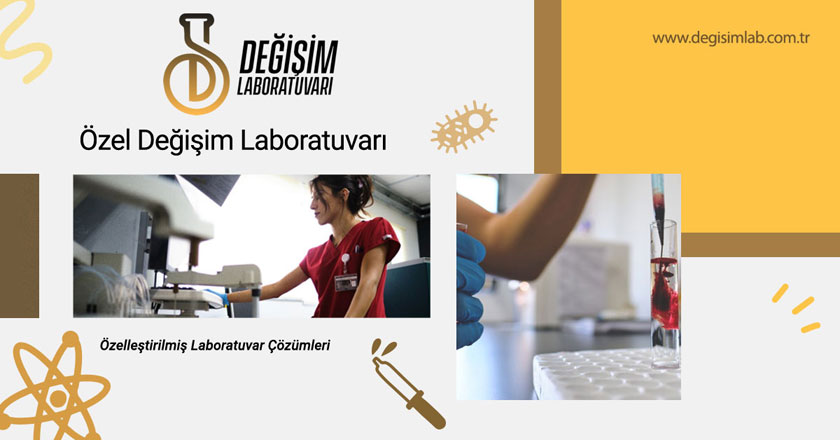 Özel Değişim Laboratuvarı